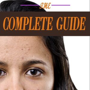 The complete Guide to Acne Treatments