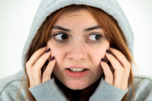 Hyperpigmentation Under Eyes